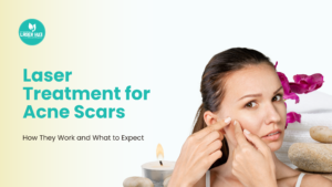 Laser Treat