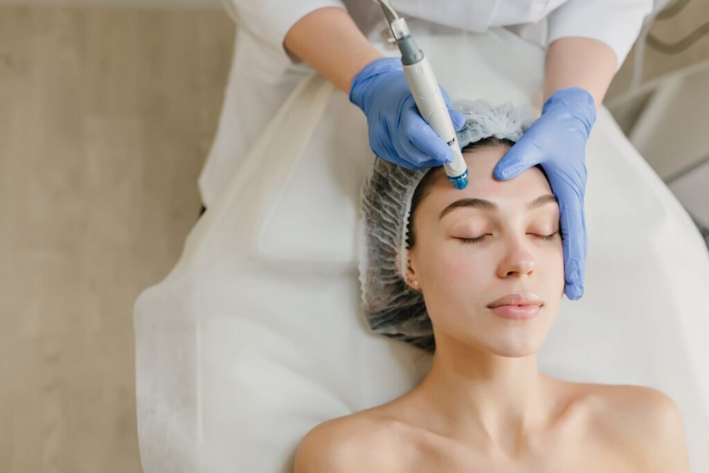 Microneedling (Vampire Facial)